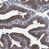 Anti-BTN3A3 antibody produced in rabbit Prestige Antibodies&#174; Powered by Atlas Antibodies, affinity isolated antibody, buffered aqueous glycerol solution