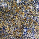 Anti-phospho-CD4 (pSer433) antibody produced in rabbit affinity isolated antibody