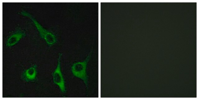 Anti-EDG1 antibody produced in rabbit affinity isolated antibody