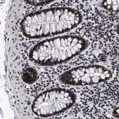 Anti-CAAP1 antibody produced in rabbit Prestige Antibodies® Powered by Atlas Antibodies, affinity isolated antibody, buffered aqueous glycerol solution, Ab1