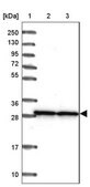 Anti-SNRPA1 antibody produced in rabbit Prestige Antibodies&#174; Powered by Atlas Antibodies, affinity isolated antibody, buffered aqueous glycerol solution