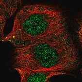 Anti-TRIT1 antibody produced in rabbit Prestige Antibodies&#174; Powered by Atlas Antibodies, affinity isolated antibody, buffered aqueous glycerol solution