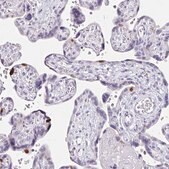 Anti-ANLN antibody produced in rabbit Prestige Antibodies&#174; Powered by Atlas Antibodies, affinity isolated antibody, buffered aqueous glycerol solution