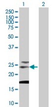 Anti-TSPAN31 antibody produced in mouse purified immunoglobulin, buffered aqueous solution