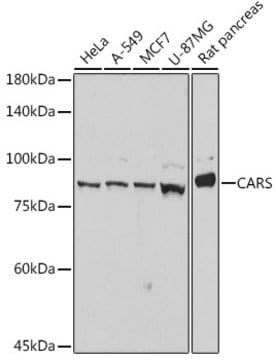 Anti-CARS Antibody, clone 7V0X1, Rabbit Monoclonal