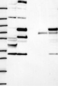Anti-Cep63 Antibody Produced In Rabbit Prestige Antibodies&#174; Powered by Atlas Antibodies, affinity isolated antibody, buffered aqueous glycerol solution