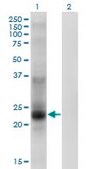 Monoclonal Anti-TSPAN8 antibody produced in mouse clone 1E5, purified immunoglobulin, buffered aqueous solution