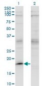 ANTI-LMO2 antibody produced in mouse clone 4E2, purified immunoglobulin, buffered aqueous solution