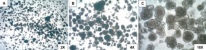 3dGRO® Endometrial Organoids (274T) Serous Papillary Carcinoma, Endometrium, Age: 92, Female, Mutation: See Product Page