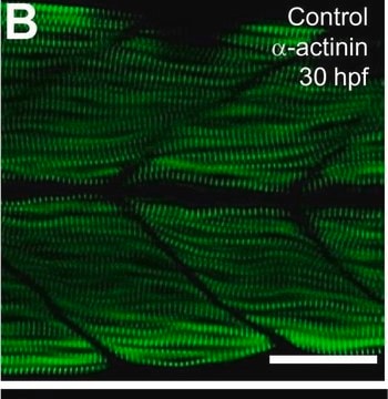 Monoclonal Anti-&#945;-Actinin (Sarcomeric) antibody produced in mouse clone EA-53, ascites fluid