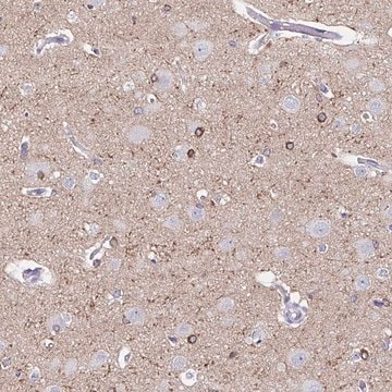 Anti-UGT3A1 antibody produced in rabbit Prestige Antibodies&#174; Powered by Atlas Antibodies, affinity isolated antibody, buffered aqueous glycerol solution