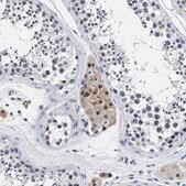 Anti-PRPF4B antibody produced in rabbit Prestige Antibodies&#174; Powered by Atlas Antibodies, affinity isolated antibody, buffered aqueous glycerol solution
