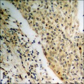 Anti-phospho-NPM (pThr199) antibody produced in rabbit affinity isolated antibody