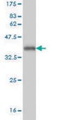 Monoclonal Anti-TREX1 antibody produced in mouse clone 2F10, purified immunoglobulin, buffered aqueous solution
