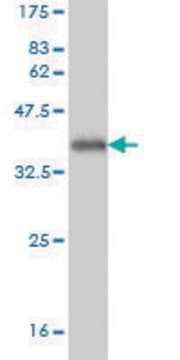 Monoclonal Anti-TREX1 antibody produced in mouse clone 2F10, purified immunoglobulin, buffered aqueous solution