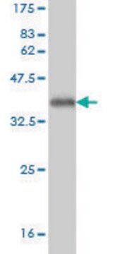 Monoclonal Anti-TREX1 antibody produced in mouse clone 2F10, purified immunoglobulin, buffered aqueous solution