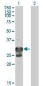 Anti-TPPP antibody produced in mouse IgG fraction of antiserum, buffered aqueous solution
