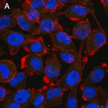 Anti-Notch1 Antibody, clone 1A32 ZooMAb&#174; Rabbit Monoclonal recombinant, expressed in HEK 293 cells