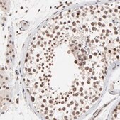 Anti-DSN1 antibody produced in rabbit Prestige Antibodies&#174; Powered by Atlas Antibodies, affinity isolated antibody, buffered aqueous glycerol solution