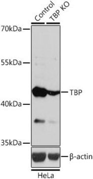 Anti-TBP antibody produced in rabbit