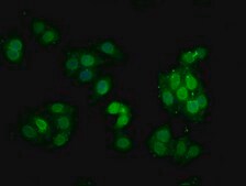 Anti-phospho-PRKCA (T638) antibody, clone 3A5, Rabbit Monoclonal recombinant, expressed in HEK293F cells