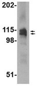 Anti-SAPAP3 Antibody from rabbit, purified by affinity chromatography