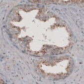 Monoclonal Anti-ACAA1 antibody produced in mouse Prestige Antibodies&#174; Powered by Atlas Antibodies, clone CL2662, purified immunoglobulin, buffered aqueous glycerol solution