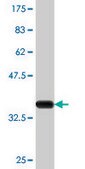 Monoclonal Anti-CYP24A1, (C-terminal) antibody produced in mouse clone 1E1, purified immunoglobulin, buffered aqueous solution