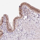 抗-ONECUT2 兔抗 Prestige Antibodies® Powered by Atlas Antibodies, affinity isolated antibody, buffered aqueous glycerol solution