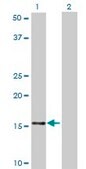 Monoclonal Anti-NDUFB7 antibody produced in mouse clone 4D4, purified immunoglobulin, buffered aqueous solution