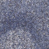 Anti-GTPBP10 antibody produced in rabbit Prestige Antibodies&#174; Powered by Atlas Antibodies, affinity isolated antibody, buffered aqueous glycerol solution