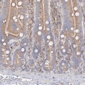 Anti-FAM114A2 antibody produced in rabbit Prestige Antibodies® Powered by Atlas Antibodies, affinity isolated antibody, buffered aqueous glycerol solution