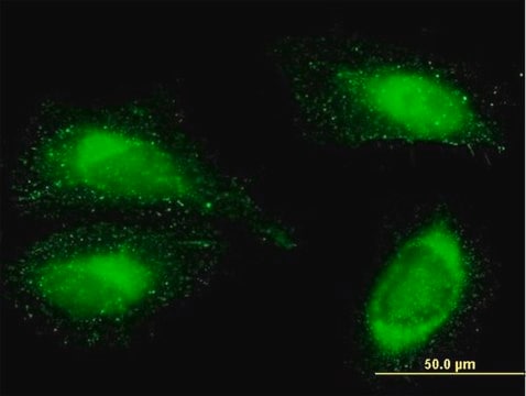 Anti-FN1 antibody produced in mouse purified immunoglobulin, buffered aqueous solution