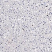 Anti-POLA1 antibody produced in rabbit Prestige Antibodies&#174; Powered by Atlas Antibodies, affinity isolated antibody, buffered aqueous glycerol solution