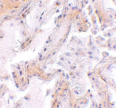 Anti-CAPN6 antibody produced in rabbit affinity isolated antibody