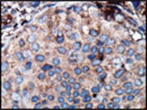 Anti-OPHN1L (center) antibody produced in rabbit IgG fraction of antiserum, buffered aqueous solution