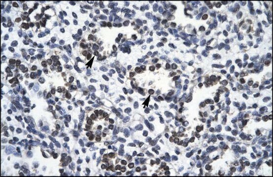 Anti-RBM10 (AB1) antibody produced in rabbit IgG fraction of antiserum