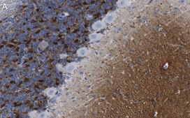 Anti-α-Synuclein Antibody, clone 2F12 ZooMAb® Mouse Monoclonal recombinant, expressed in HEK 293 cells