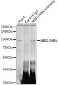 Anti-NBS1/NBN Antibody, clone 4G4R1, Rabbit Monoclonal