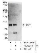Rabbit anti-BAP1 Antibody, Affinity Purified Powered by Bethyl Laboratories, Inc.