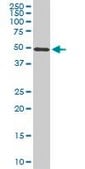 Monoclonal Anti-STK38 antibody produced in mouse clone 3A5, purified immunoglobulin, buffered aqueous solution
