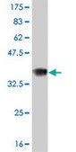 ANTI-RCV1 antibody produced in mouse clone 4C10, purified immunoglobulin, buffered aqueous solution