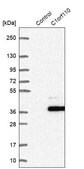 Anti-CCDC190 antibody produced in rabbit Prestige Antibodies&#174; Powered by Atlas Antibodies, affinity isolated antibody, buffered aqueous glycerol solution, ab1