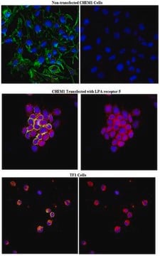 Anti-LPA receptor 5 Antibody (GPR92) from rabbit, purified by affinity chromatography