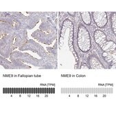 Anti-NME9 antibody produced in rabbit Prestige Antibodies® Powered by Atlas Antibodies, affinity isolated antibody, buffered aqueous glycerol solution