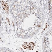 Anti-FAM71F2 antibody produced in rabbit Prestige Antibodies&#174; Powered by Atlas Antibodies, affinity isolated antibody, buffered aqueous glycerol solution