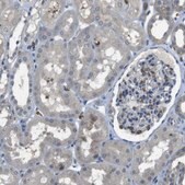 Anti-GYPA antibody produced in rabbit Prestige Antibodies&#174; Powered by Atlas Antibodies, affinity isolated antibody, buffered aqueous glycerol solution