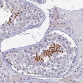 Anti-PRR22 antibody produced in rabbit Prestige Antibodies&#174; Powered by Atlas Antibodies, affinity isolated antibody, buffered aqueous glycerol solution
