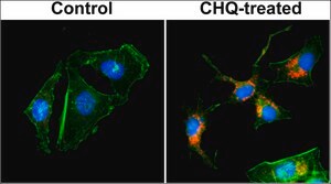 Anti-LC3B antibody, Rabbit Monoclonal recombinant, expressed in HEK 293 cells, clone RM293, purified immunoglobulin