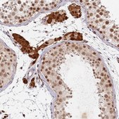Anti-ATF6B antibody produced in rabbit affinity isolated antibody, buffered aqueous glycerol solution